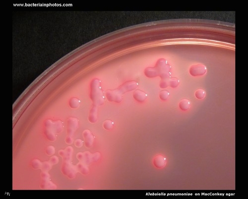 klebsiella on macconkey agar